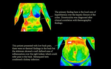 Real Early Detection: Thermography - Holistic Health Alternatives