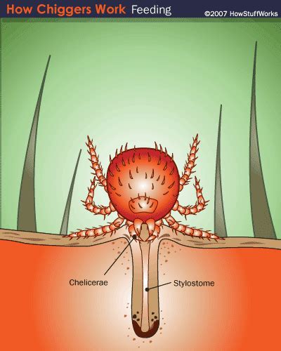 Chiggers and Trombiculosis | Nebraska Forest Service