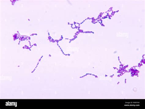 Viridans Streptococci