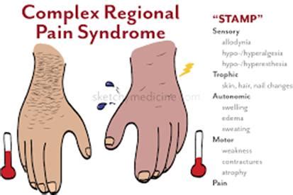 Complex Regional Pain Syndrome - Neuropathy Center Northern Colorado