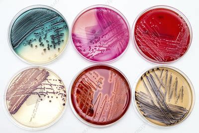 Bacterial growth on culture media - Stock Image - C029/1373 - Science ...