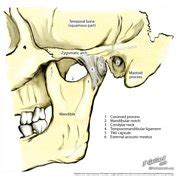 Temporomandibular joint | Radiology Reference Article | Radiopaedia.org