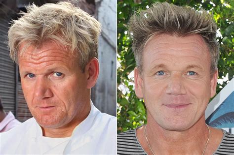 Gordon Ramsay Plastic Surgery: A Close Look Before and After