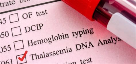 Beta Thalassemia Treatment Cost in India from Best Doctor