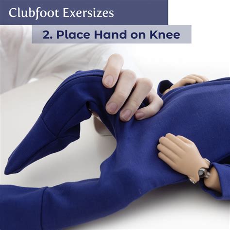 Clubfoot Exercises - StandInBaby®