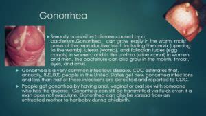 Chlamydia and gonorrhea symptoms male - japanright
