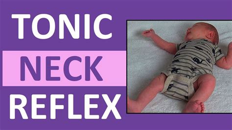 Tonic Neck Reflex in Infant Newborn | Pediatric Nursing Newborn Assessment - YouTube