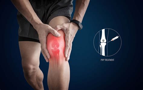 Platelet Rich Plasma (PRP) Therapy for the Knee – Dr. Amit Nathani, MD