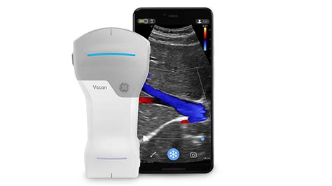 GE Healthcare announces its first wireless portable ultrasound device | MobiHealthNews