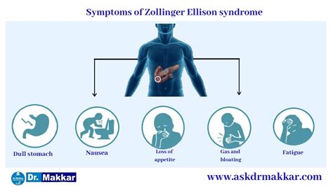 Zollinger Ellison Syndrome Homopathic treatment India Punjab