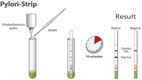 Helicobacter pylori rapid antigen test - stool antigen test — Sterilab Services Pathology Solutions