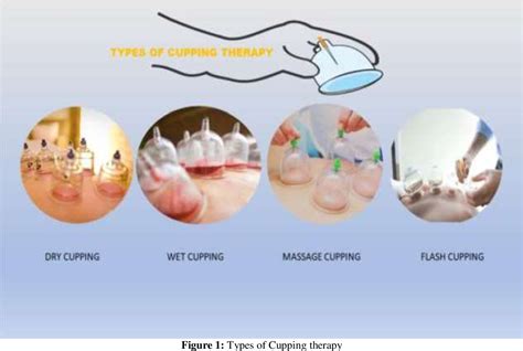 Figure 1 from The Role of Cupping Therapy (CT) In Pain Tackling, an Insight into Mechanism ...