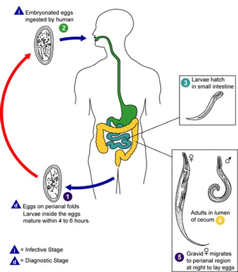 How to Get Rid of Pinworms and Itchy Anus | HealDove