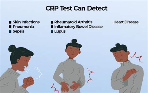 C-reactive Protein (CRP) Symptoms Lab Test Information, 45% OFF