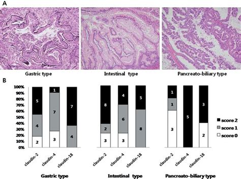 (A) Histological IPMN subtypes by hematoxylin and eosin staining.... | Download Scientific Diagram