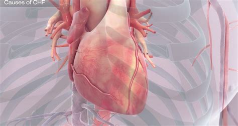 Explaining Congestive Heart Failure Using 3D Medical Animation | by ScientificAnimations | Medium