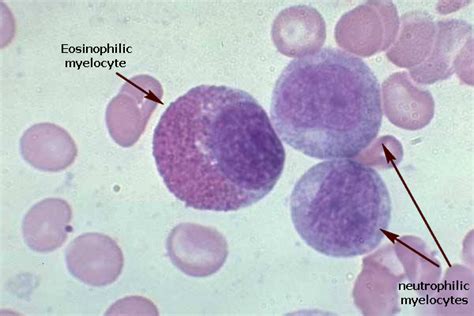 Basophilic Myelocyte