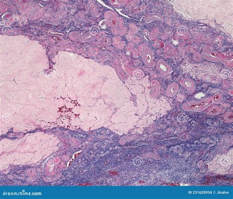 Corpus Albicans Histology