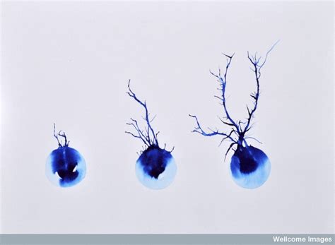 B0009501 Neurone development, artwork - Jon Lieff, MD