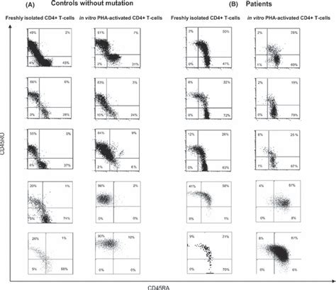 CD45RA and RO isoforms expression pattern in freshly isolated and in ...