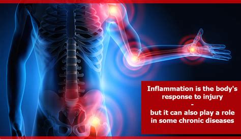 Inflammation is the body's response to injury, but it can also play a role in some chronic ...