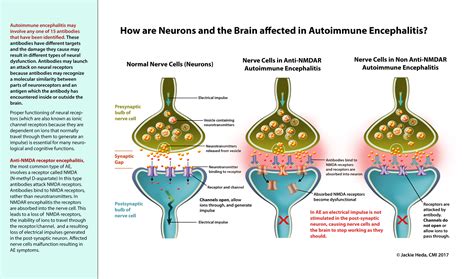 How is the Brain Affected in Autoimmune Encephalitis? - Jackie Heda | Biomedical & Scientific ...