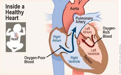 Truncus Arteriosus (for Parents) - Arkansas Children's