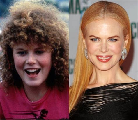 25 fotografías del antes y después de las celebridades