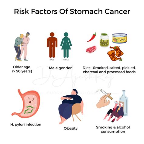 Know everything about stomach cancers