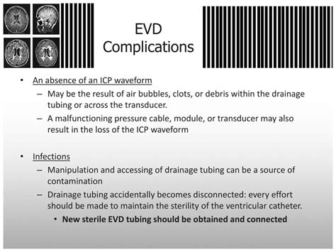 External Ventricular Drain Ppt - Best Drain Photos Primagem.Org