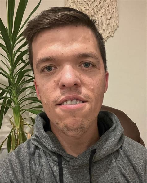 Zach Roloff Gives Update On Son’s ‘Tough’ Recovery From Surgery | Us Weekly