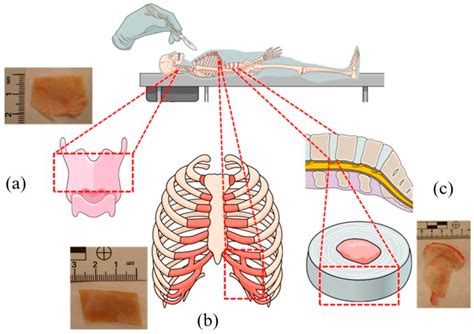 Epiglottis Cartilage, Costal Cartilage, and Intervertebral Disc Cartilage as Alternative ...