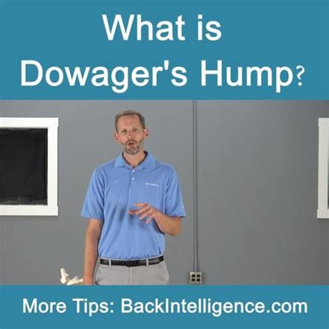 How to fix dowager’s hump causes symptoms exercises – Artofit