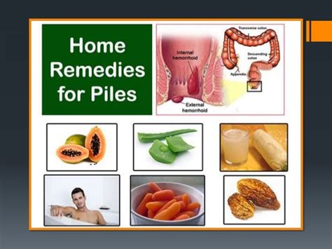 How To Cure External Piles Naturally At Home - Grizzbye