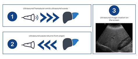 The Basics of Thyroid Ultrasound - RFA For Life