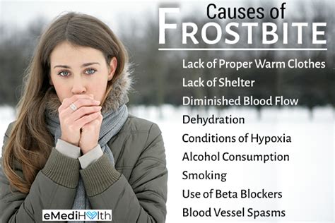 The Different Stages of Frostbite & Ways to Treat Them