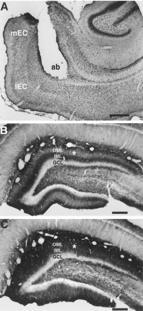 Photomicrographs of representative sections through the entorhinal... | Download Scientific Diagram