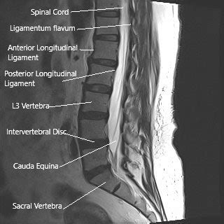 Spinal Cord Anatomy Cauda Equina