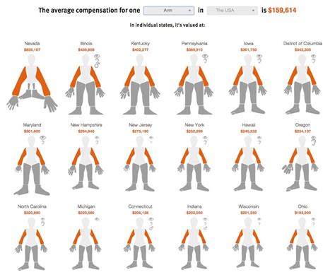 Workers’ Comp Benefits: How Much is a Limb Worth? | Dataviz