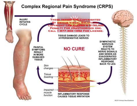 Trying To Live With Chronic Pain - MED Partnership Group