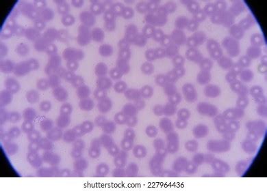 Blood Smear Red Blood Cells Under Stock Photo 227964436 | Shutterstock