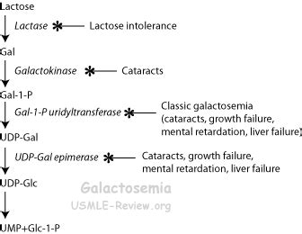 Sugar Disorders - USMLE Review