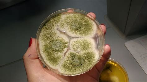 Aspergillus fumigatus sabouraud agar plate | Microbiology, Fungi ...