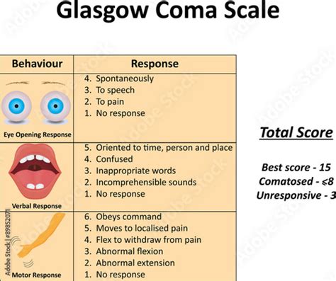 Glasgow Coma Scale Illustration Illustration Stock | Adobe Stock