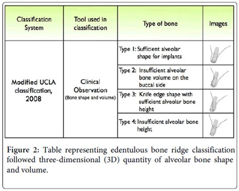 Reference and Techniques used in Alveolar Bone Classification | OMICS ...