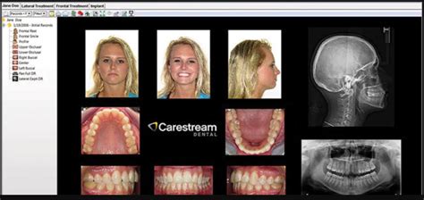 Carestream Dental EMR Software | Latest Reviews, Pricing & Demo ...