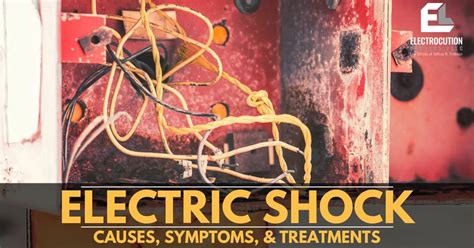 What Is Electric Shock: Causes, Symptoms, Treatments, Safety