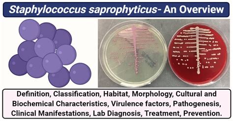 Staphylococcus saprophyticus- An Overview - Microbe Notes (2022)