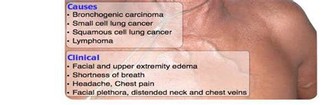 These are the causes and clinical features of superior vena - MEDizzy