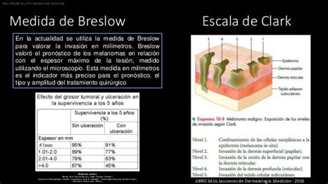 Escala De Clark Melanoma